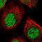 PTK6 antibody, NBP1-89935, Novus Biologicals, Immunofluorescence image 