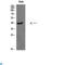 Casein Kinase 1 Alpha 1 antibody, LS-C814149, Lifespan Biosciences, Immunohistochemistry paraffin image 