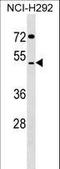 SDS3 Homolog, SIN3A Corepressor Complex Component antibody, LS-C157111, Lifespan Biosciences, Western Blot image 