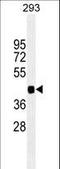 Paired Box 6 antibody, LS-C163391, Lifespan Biosciences, Western Blot image 