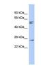 Retinal Degeneration 3, GUCY2D Regulator antibody, NBP1-55461, Novus Biologicals, Western Blot image 