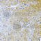 Bone morphogenetic protein 3 antibody, A6877, ABclonal Technology, Immunohistochemistry paraffin image 
