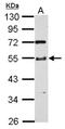 Tetratricopeptide Repeat Domain 31 antibody, NBP2-20754, Novus Biologicals, Western Blot image 