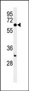 Macrophage Receptor With Collagenous Structure antibody, ab103311, Abcam, Western Blot image 