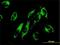 Nicotinamide Nucleotide Transhydrogenase antibody, H00023530-M01, Novus Biologicals, Immunofluorescence image 