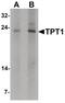 Tumor Protein, Translationally-Controlled 1 antibody, PA5-34503, Invitrogen Antibodies, Western Blot image 