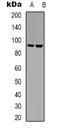 Leukocyte Receptor Tyrosine Kinase antibody, abx133475, Abbexa, Western Blot image 