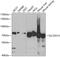 Citrin antibody, 19-897, ProSci, Western Blot image 
