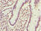 Cytosolic Iron-Sulfur Assembly Component 1 antibody, LS-C682097, Lifespan Biosciences, Immunohistochemistry paraffin image 