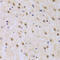 Interleukin Enhancer Binding Factor 2 antibody, 19-916, ProSci, Immunohistochemistry paraffin image 