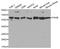 Prolyl 4-Hydroxylase Subunit Beta antibody, STJ24881, St John