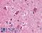 Pro-Apoptotic WT1 Regulator antibody, LS-B4094, Lifespan Biosciences, Immunohistochemistry paraffin image 