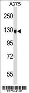 Oxysterol Binding Protein Like 6 antibody, 59-228, ProSci, Western Blot image 