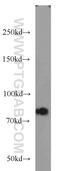 Prolyl 3-Hydroxylase 2 antibody, 15723-1-AP, Proteintech Group, Western Blot image 