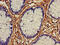 Aldehyde Dehydrogenase 1 Family Member A2 antibody, CSB-PA001566EA01HU, Cusabio, Immunohistochemistry paraffin image 
