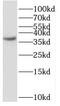 Secretory Carrier Membrane Protein 1 antibody, FNab07620, FineTest, Western Blot image 
