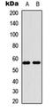 Membrane Bound Transcription Factor Peptidase, Site 2 antibody, orb256679, Biorbyt, Western Blot image 