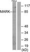 Microtubule Affinity Regulating Kinase 1 antibody, TA314175, Origene, Western Blot image 