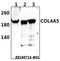 Collagen Type IV Alpha 5 Chain antibody, A01457, Boster Biological Technology, Western Blot image 