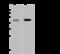 Galactosidase Alpha antibody, GTX02083, GeneTex, Western Blot image 