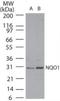 NAD(P)H Quinone Dehydrogenase 1 antibody, NBP2-23792, Novus Biologicals, Western Blot image 