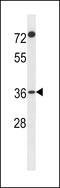 Protein FAM110A antibody, 60-949, ProSci, Western Blot image 