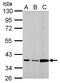 Annexin A3 antibody, GTX114253, GeneTex, Western Blot image 
