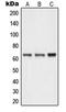 Neuralized E3 Ubiquitin Protein Ligase 1 antibody, GTX55911, GeneTex, Western Blot image 