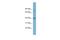 CASC3 Exon Junction Complex Subunit antibody, A05890, Boster Biological Technology, Western Blot image 