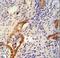 Caseinolytic Mitochondrial Matrix Peptidase Chaperone Subunit antibody, LS-C168856, Lifespan Biosciences, Immunohistochemistry paraffin image 