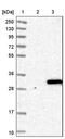 Trans-Golgi Network Vesicle Protein 23 Homolog B antibody, PA5-54030, Invitrogen Antibodies, Western Blot image 