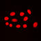 Transcriptional Adaptor 2A antibody, LS-C352901, Lifespan Biosciences, Immunofluorescence image 