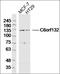 Complement C1q A Chain antibody, orb155963, Biorbyt, Western Blot image 
