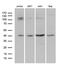 DnaJ Heat Shock Protein Family (Hsp40) Member B5 antibody, M13716, Boster Biological Technology, Western Blot image 