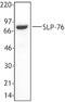 Lymphocyte Cytosolic Protein 2 antibody, LS-C41105, Lifespan Biosciences, Western Blot image 