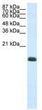 Zinc Finger Protein 786 antibody, TA345541, Origene, Western Blot image 