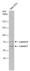 Lamin A/C antibody, GTX101126, GeneTex, Western Blot image 