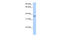 Vestigial Like Family Member 2 antibody, 30-664, ProSci, Western Blot image 