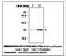 Superoxide Dismutase 2 antibody, LS-C61935, Lifespan Biosciences, Immunoprecipitation image 