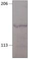 Guanylate Cyclase 2D, Retinal antibody, GTX14786, GeneTex, Western Blot image 