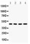 Angio Associated Migratory Cell Protein antibody, PB9123, Boster Biological Technology, Western Blot image 