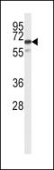 Solute Carrier Family 22 Member 6 antibody, LS-B10034, Lifespan Biosciences, Western Blot image 