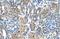 Metastasis Associated 1 Family Member 2 antibody, A03073, Boster Biological Technology, Immunohistochemistry frozen image 