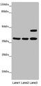 Major Histocompatibility Complex, Class I-Related antibody, abx318724, Abbexa, Western Blot image 