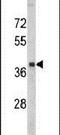 Ribonucleotide Reductase Regulatory Subunit M2 antibody, PA5-13570, Invitrogen Antibodies, Western Blot image 