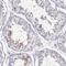 WBP2 N-Terminal Like antibody, NBP2-33531, Novus Biologicals, Immunohistochemistry paraffin image 