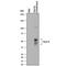 Cytokine Receptor Like Factor 2 antibody, AF981, R&D Systems, Western Blot image 