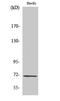 Guanylate Cyclase 1 Soluble Subunit Beta 1 antibody, A11395, Boster Biological Technology, Western Blot image 