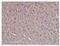Ubiquitin C-Terminal Hydrolase L1 antibody, M01018-6, Boster Biological Technology, Immunohistochemistry paraffin image 