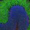 Spectrin alpha chain, brain antibody, M03831, Boster Biological Technology, Immunofluorescence image 